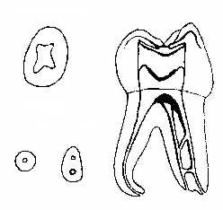 The complex canal structure of a molar